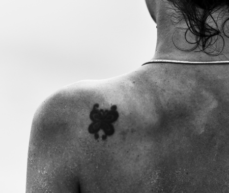 Paul Banwell - Surgical Tattoo Removal