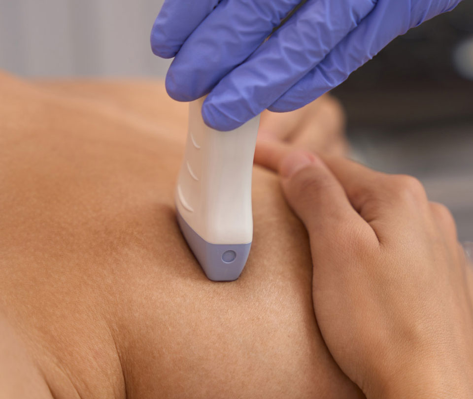 Paul Banwell - Breast Ultrasound Service Homepage Highlight